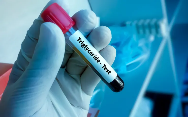 7 Natural Ways to Lower Triglycerides Starting Today